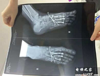 8.22_3_结果.jpg